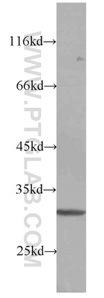 RPS4Y1 Antibody in Western Blot (WB)