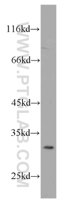 RPS4Y1 Antibody in Western Blot (WB)