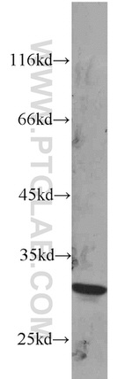 RPS4Y1 Antibody in Western Blot (WB)