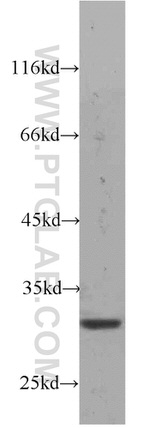 RPS4Y1 Antibody in Western Blot (WB)