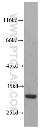 RPS4Y1 Antibody in Western Blot (WB)