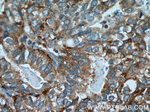 AGA Antibody in Immunohistochemistry (Paraffin) (IHC (P))