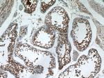 AGA Antibody in Immunohistochemistry (Paraffin) (IHC (P))