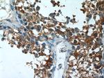 AGA Antibody in Immunohistochemistry (Paraffin) (IHC (P))