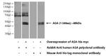 AGA Antibody in Western Blot (WB)