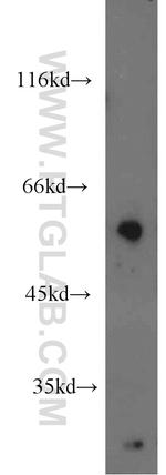 ENPP4 Antibody in Western Blot (WB)