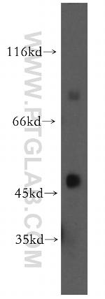 TGDS Antibody in Western Blot (WB)