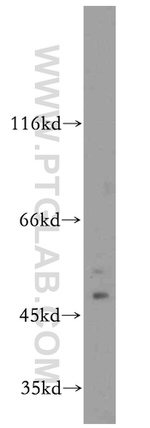 TGDS Antibody in Western Blot (WB)