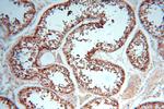 ERLIN1 Antibody in Immunohistochemistry (Paraffin) (IHC (P))