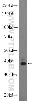 ERLIN1 Antibody in Western Blot (WB)