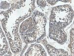 EXD1 Antibody in Immunohistochemistry (Paraffin) (IHC (P))