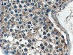 EXD1 Antibody in Immunohistochemistry (Paraffin) (IHC (P))
