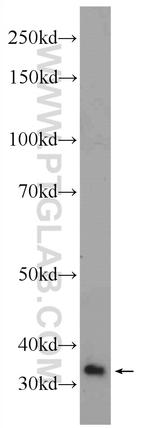 EXD1 Antibody in Western Blot (WB)