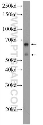 EXD1 Antibody in Western Blot (WB)