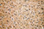 CLYBL Antibody in Immunohistochemistry (Paraffin) (IHC (P))
