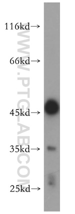CLYBL Antibody in Western Blot (WB)