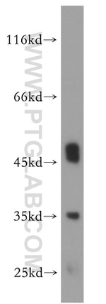 CLYBL Antibody in Western Blot (WB)