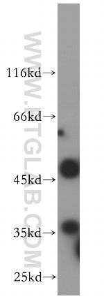 CLYBL Antibody in Western Blot (WB)