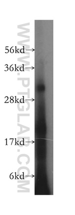 HLA-DQB2 Antibody in Western Blot (WB)