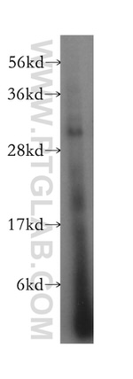 HLA-DQB2 Antibody in Western Blot (WB)