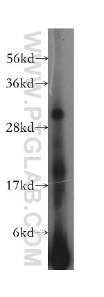 HLA-DQB2 Antibody in Western Blot (WB)