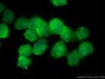 NUDT18 Antibody in Immunocytochemistry (ICC/IF)
