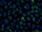 ALDH5A1 Antibody in Immunocytochemistry (ICC/IF)