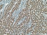 ALDH5A1 Antibody in Immunohistochemistry (Paraffin) (IHC (P))