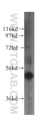 ALDH5A1 Antibody in Western Blot (WB)
