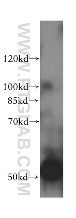ALDH5A1 Antibody in Western Blot (WB)