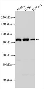 ALDH16A1 Antibody in Western Blot (WB)