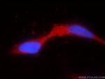 TRPV5 Antibody in Immunocytochemistry (ICC/IF)