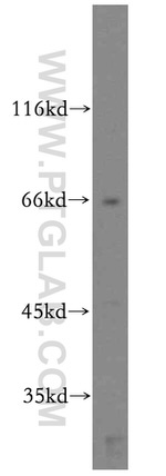 CD1a Antibody in Western Blot (WB)