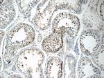 TSGA13 Antibody in Immunohistochemistry (Paraffin) (IHC (P))