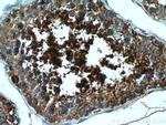 LIPE Antibody in Immunohistochemistry (Paraffin) (IHC (P))
