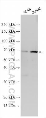 ACTR8 Antibody in Western Blot (WB)