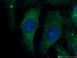 JNK2 Antibody in Immunocytochemistry (ICC/IF)