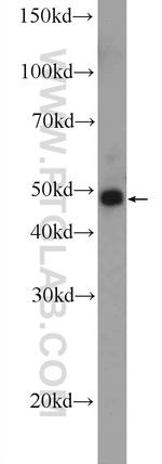 JNK2 Antibody in Western Blot (WB)