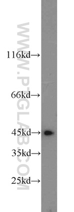 MEK4 Antibody in Western Blot (WB)