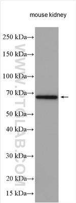 SLC5A10 Antibody in Western Blot (WB)