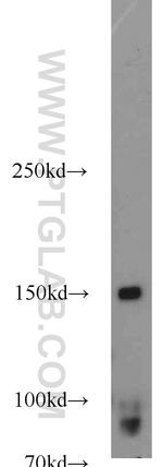 CD11c/Integrin alpha X Antibody in Western Blot (WB)