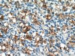 PLAC1L Antibody in Immunohistochemistry (Paraffin) (IHC (P))