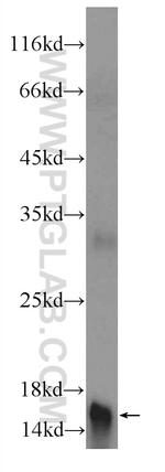 PLAC1L Antibody in Western Blot (WB)