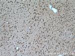 SLC25A18 Antibody in Immunohistochemistry (Paraffin) (IHC (P))