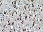 SLC25A18 Antibody in Immunohistochemistry (Paraffin) (IHC (P))