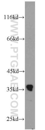 SLC25A18 Antibody in Western Blot (WB)