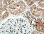 TIMP-2 Antibody in Immunohistochemistry (Paraffin) (IHC (P))