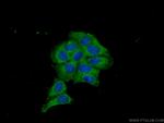 MKNK2 Antibody in Immunocytochemistry (ICC/IF)