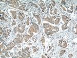 MKNK2 Antibody in Immunohistochemistry (Paraffin) (IHC (P))