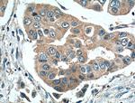 MKNK2 Antibody in Immunohistochemistry (Paraffin) (IHC (P))